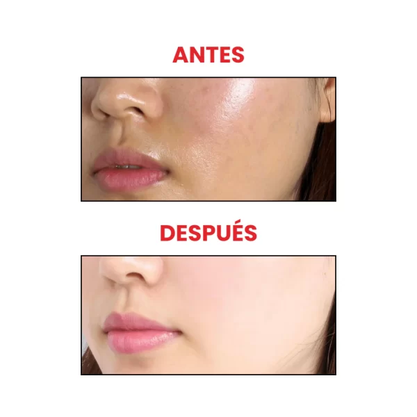 Peach-70-Niacinamide-Niacinamida-Serum-Anua-3